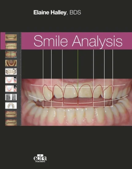 Smile Analysis 1st Edition
