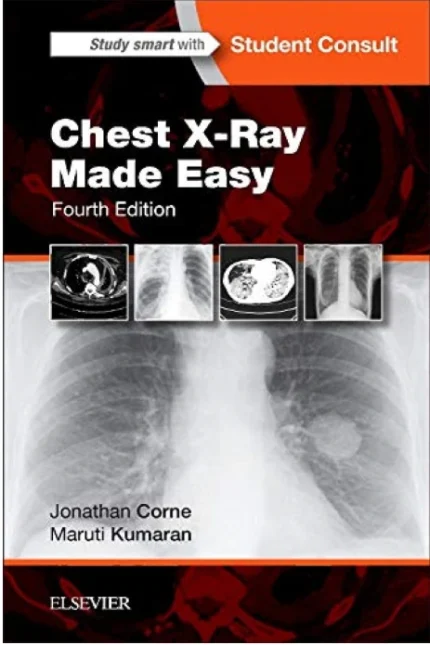Chest X-Ray Made Easy 4th Edition