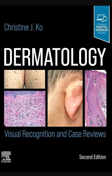 Dermatology Visual Recognition And Case Reviews 2nd Edition