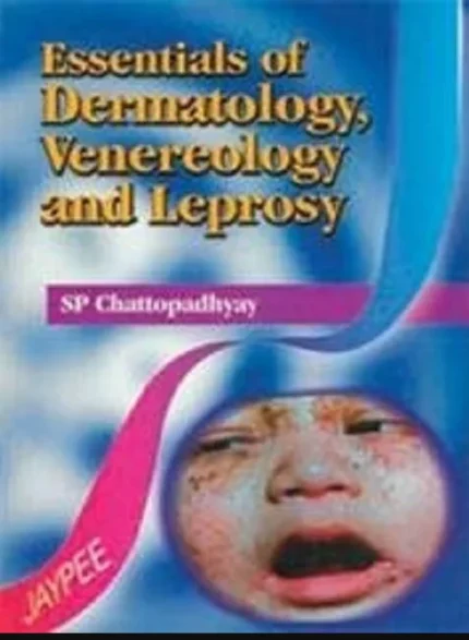 Essentials of Dermatology Venerology and Leprosy