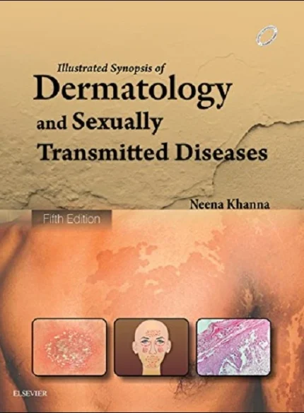 Illustrated Synopsis of Dermatology & Sexually Transmitted Diseases 5th Edition