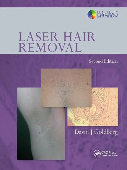 Laser Hair Removal 2nd Edition Book Image