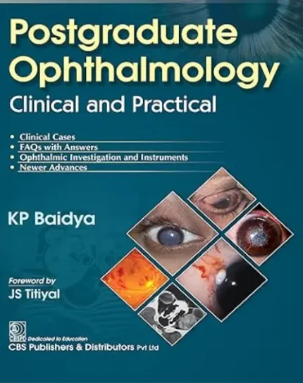 Postgraduate Ophthalmology Clinical and Practical