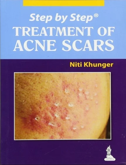 Step by Step Treatment of Acne Scars 1st Edition