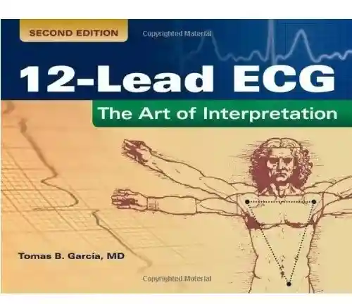 12 Lead ECG The Art of Interpretation The Art of Interpretation 2nd Edition 12 Lead ECG The Art of Interpretation The Art of Interpretation 2nd Edition