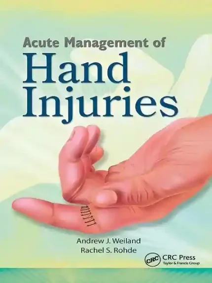 Acute Management of Hand Injuries 1st Edition