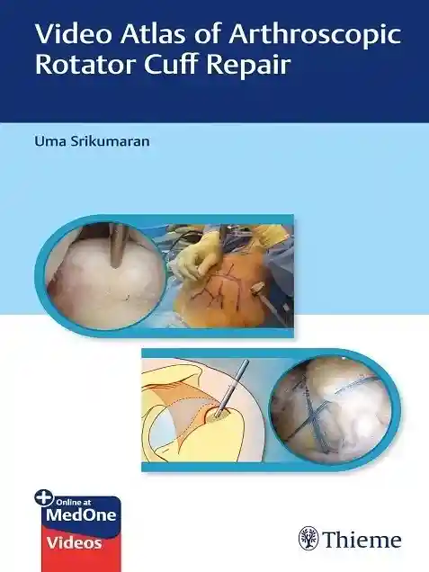 Video Atlas of Arthroscopic Rotator Cuff Repair 1st Edition Video Atlas of Arthroscopic Rotator Cuff Repair 1st Edition