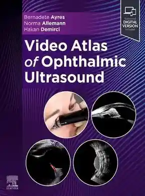 Video Atlas of Ophthalmic Ultrasound 1st Edition Video Atlas of Ophthalmic Ultrasound 1st Edition