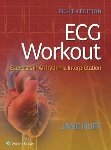 ECG Workout Exercises in Arrhythmia Interpretation 8th Edition