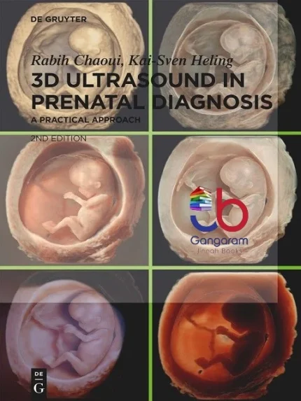 Cover Image for 3D Ultrasound in Prenatal Diagnosis A Practical Approach 2nd Edition
