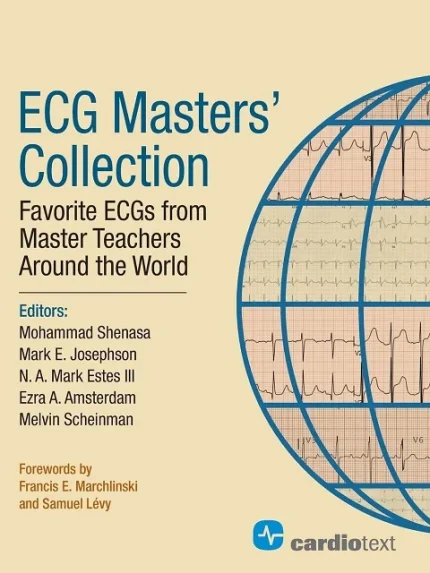 Cover Image for ECG Masters Collection Favorite ECGs from Around the World 1st Edition