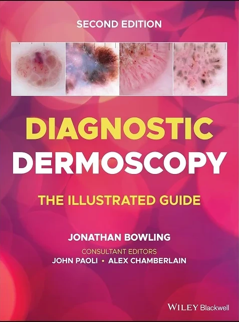 Diagnostic Dermoscopy The Illustrated Guide 2nd Edition