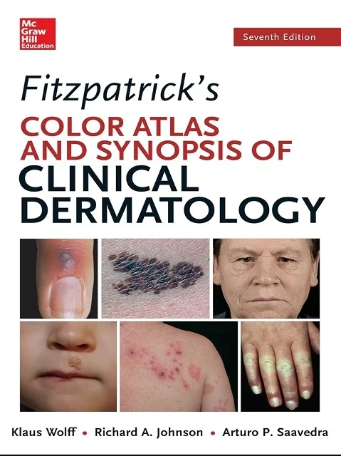 Fitzpatricks Color Atlas and Synopsis of Clinical Dermatology 7th Edition