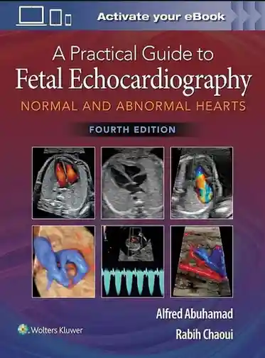 A Practical Guide to Fetal Echocardiography 4th Edition